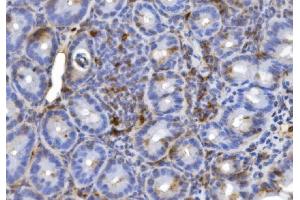 IHC analysis of CD20/MS4A1 using anti-CD20/MS4A1 antibody (ABIN7599223).