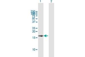 Western Blot analysis of BST2 expression in transfected 293T cell line by BST2 MaxPab polyclonal antibody. (BST2 抗体  (AA 40-180))