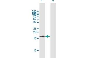 Western Blot analysis of BST2 expression in transfected 293T cell line by BST2 MaxPab polyclonal antibody. (BST2 抗体  (AA 40-180))
