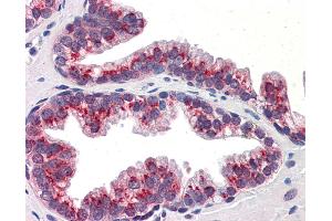 Anti-KLF4 antibody IHC of human prostate.