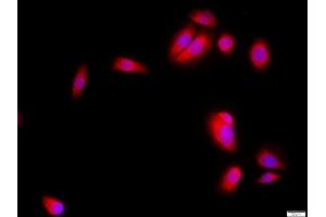 MCF-7 cells were stained with SKP2 Polyclonal Antibody, Unconjugated at 1:500 in PBS and incubated for two hours at 37°C followed by Goat Anti-Rabbit IgG (H+L) Cy3 conjugated secondary antibody. (SKP2 抗体  (AA 351-424))