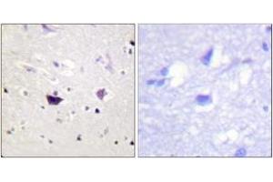 Immunohistochemistry analysis of paraffin-embedded human brain tissue, using PAK1/2/3 (Ab-144/141/139) Antibody. (PAK1/2/3 抗体  (AA 111-160))
