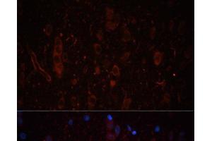 Immunofluorescence analysis of Rat brain using LAMC1 Polyclonal Antibody at dilution of 1:100. (Laminin gamma 1 抗体)
