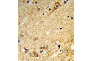 Immunohistochemistry analysis in formalin-fixed and paraffin-embedded human brain tissue reacted with Tricellulin Antibody (C-term) followed which was peroxidase-conjugated to the secondary antibody, followed by DAB staining. (Tricellulin 抗体  (C-Term))