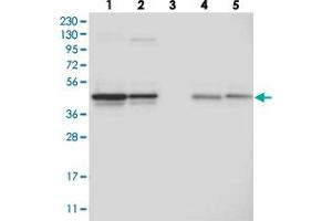 Western blot analysis of Lane 1: RT-4, Lane 2: U-251 MG, Lane 3: Human Plasma, Lane 4: Liver, Lane 5: Tonsil with CCBL2 polyclonal antibody  at 1:250-1:500 dilution. (CCBL2 抗体)