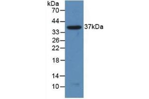 Detection of Recombinant NFkB2, Human using Polyclonal Antibody to Nuclear Factor Kappa B2 (NFkB2) (Nuclear Factor kappa B2 (AA 38-343) 抗体)
