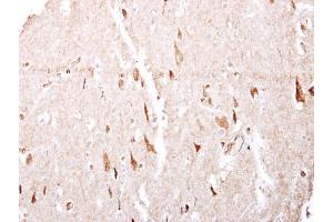 IHC-P Image GABA B Receptor 1 antibody [N2C1], Internal detects GABA B Receptor 1 protein at cytosol on human brain by immunohistochemical analysis. (GABBR1 抗体)