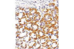 Immunohistochemical analysis of paraffin-embedded R. (Cytochrome C1 抗体  (AA 142-176))
