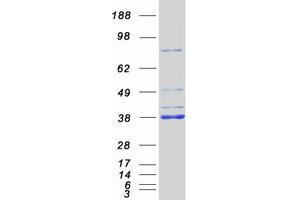 Validation with Western Blot (MYD88 Protein (Myc-DYKDDDDK Tag))
