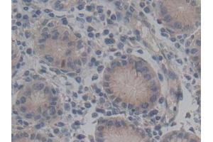 Immunohistochemistry (IHC) image for anti-ATP-Binding Cassette, Sub-Family C (CFTR/MRP), Member 2 (ABCC2) (AA 1300-1534) antibody (ABIN7441076)