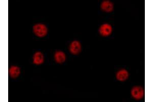 ABIN6274379 staining COLO205 cells by IF/ICC. (MAPKAP Kinase 3 抗体  (C-Term))