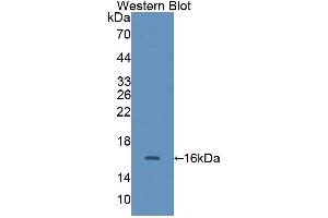 Detection of Recombinant CALD, Rat using Polyclonal Antibody to Caldesmon (CALD) (Caldesmon 抗体  (AA 434-531))