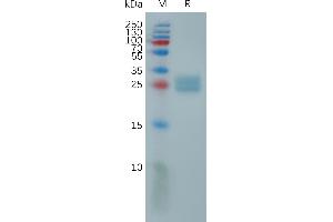 SDS-PAGE (SDS) image for UL16 Binding Protein 2 (ULBP2) (AA 26-216) protein (His tag) (ABIN7491245)
