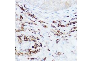 Immunohistochemistry (IHC) image for anti-Neural Precursor Cell Expressed, Developmentally Down-Regulated 9 (NEDD9) (AA 60-174) antibody (ABIN3023331)