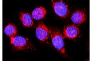 IF analysis of EHD1 using anti-EHD1 antibody (ABIN7602880). (EHD1 抗体  (C-Term))