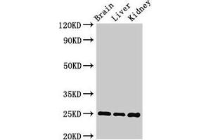 Western Blot Positive WB detected in: Mouse brain tissue, Mouse liver tissue, Mouse kidney tissue All lanes: VAMP7 antibody at 2 μg/mL Secondary Goat polyclonal to rabbit IgG at 1/50000 dilution Predicted band size: 25, 31, 21 kDa Observed band size: 25 kDa (VAMP7 抗体  (AA 2-186))