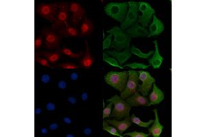 ABIN7094565 and ABIN7098614 staining Hela cells by IF/ICC. (SMG6 抗体  (N-Term))