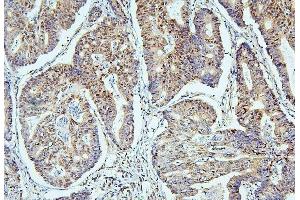 IHC analysis of SAE2/UBA2 using anti-SAE2/UBA2 antibody (ABIN7601755). (UBA2 抗体  (AA 449-564))