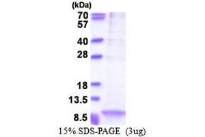 SDS-PAGE (SDS) image for Apolipoprotein C-I (APOC1) (AA 27-83) protein (His tag) (ABIN5853538) (APOC1 Protein (AA 27-83) (His tag))