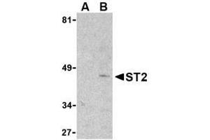 Image no. 1 for anti-Interleukin 1 Receptor-Like 1 (IL1RL1) (N-Term) antibody (ABIN206539) (IL1RL1 抗体  (N-Term))