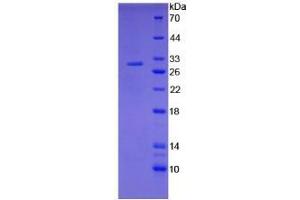 Image no. 1 for Coagulation Factor III (thromboplastin, Tissue Factor) (F3) (AA 30-252) (Active) protein (His tag) (ABIN6239858)