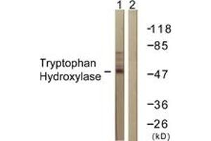 Western blot analysis of extracts from Jurkat cells, using Tryptophan Hydroxylase (Ab-260) Antibody. (Tryptophan Hydroxylase 1 抗体  (AA 231-280))