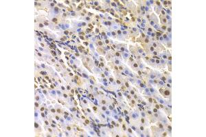 Immunohistochemistry of paraffin-embedded rat kidney using DTNBP1 antibody at dilution of 1:100 (x400 lens). (DTNBP1 抗体)