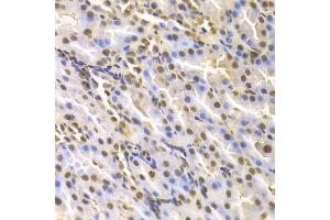 Immunohistochemistry of paraffin-embedded rat kidney using DTNBP1 antibody at dilution of 1:100 (x400 lens). (DTNBP1 抗体)
