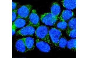 IF analysis of p75 NGF Receptor/NGFR using anti-p75 NGF Receptor/NGFR antibody (ABIN7601116).
