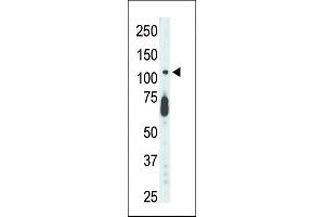 Antibody is used in Western blot to detect STK9 in mouse lung tissue lysate. (CDKL5 抗体  (C-Term))