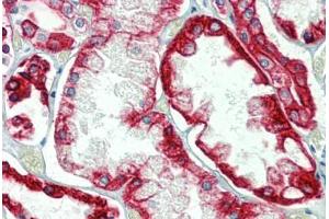 Kidney, Human: Formalin-Fixed, Paraffin-Embedded (FFPE) (Cytokeratin 18 抗体)
