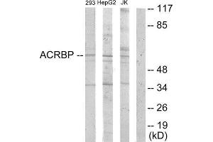 Western Blotting (WB) image for anti-Acrosin Binding Protein (ACRBP) (Internal Region) antibody (ABIN1849784) (ACRBP 抗体  (Internal Region))