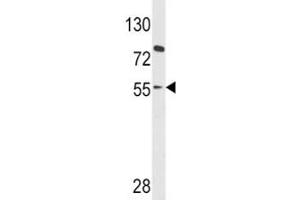 Western Blotting (WB) image for anti-Paired Box 8 (PAX8) (AA 285-313) antibody (ABIN3032136)