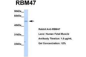 Host: Rabbit  Target Name: RBM47  Sample Tissue: Human Fetal Muscle  Antibody Dilution: 1. (RBM47 抗体  (Middle Region))