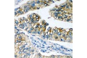 Immunohistochemical analysis of NBC1 staining in human prostate formalin fixed paraffin embedded tissue section. (SLC4A4 抗体)