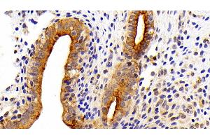 Detection of CK7 in Rat Uterus Tissue using Polyclonal Antibody to Cytokeratin 7 (CK7) (Cytokeratin 7 抗体  (AA 394-457))