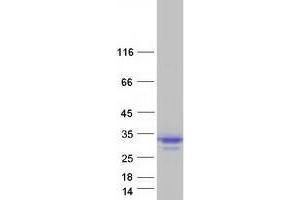 Validation with Western Blot