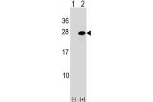 Western Blotting (WB) image for anti-Activating Transcription Factor 3 (ATF3) antibody (ABIN2998842) (ATF3 抗体)