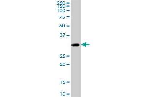 CENPH MaxPab rabbit polyclonal antibody. (CENPH 抗体  (AA 1-247))