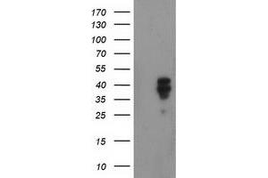 Western Blotting (WB) image for anti-NudE Nuclear Distribution E Homolog (A. Nidulans)-Like 1 (NDEL1) antibody (ABIN1499851) (NDEL1 抗体)