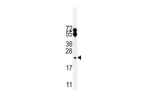 Western Blotting (WB) image for anti-Family with Sequence Similarity 96, Member A (FAM96A) (AA 109-138), (C-Term) antibody (ABIN5530641)