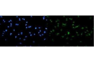 IF analysis of SAMHD1 using anti-SAMHD1 antibody (ABIN7601516).