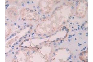 Immunohistochemistry (IHC) image for anti-Butyrylcholinesterase (BCHE) (AA 29-150) antibody (ABIN7434839)