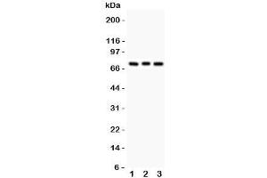 Western blot testing of PKC beta antibody and Lane 1:  rat brain;  2: mouse brain;  3: human COLO320. (Pkc beta 1 抗体  (AA 542-671))