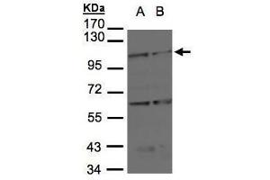 WB Image Sample(30 μg of whole cell lysate) A:H1299 B:Raji , 7. (BMPR2 抗体  (C-Term))