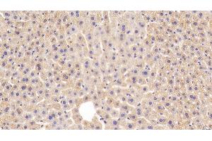 Immunohistochemistry (IHC) image for anti-Fatty Acid Desaturase 2 (FADS2) (AA 1-130) antibody (ABIN7436027)