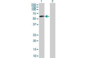 Western Blot analysis of ZBTB6 expression in transfected 293T cell line by ZBTB6 MaxPab polyclonal antibody. (ZBTB6 抗体  (AA 1-424))