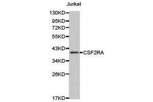 Western Blotting (WB) image for anti-Colony Stimulating Factor 2 Receptor, Alpha, Low-Affinity (Granulocyte-Macrophage) (CSF2RA) antibody (ABIN1872028) (CSF2RA 抗体)