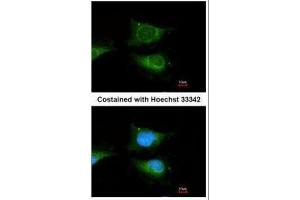 ICC/IF Image Immunofluorescence analysis of methanol-fixed HeLa, using GBA, antibody at 1:100 dilution. (GBA 抗体  (C-Term))
