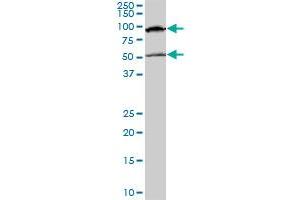 MECP2 monoclonal antibody (M01), clone 4B6. (MECP2 抗体  (AA 81-170))
